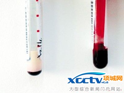 ����ѪҺ��ţ�̰�