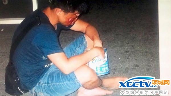 中国儿童遭拐卖到马来西亚行乞 被致残毁容