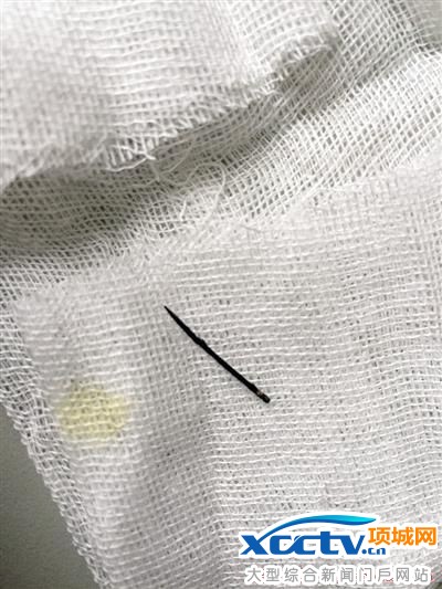 取出的已生锈的针。 儿童医院供图