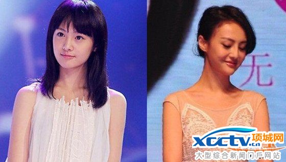 娱乐圈整容的明星:郑爽