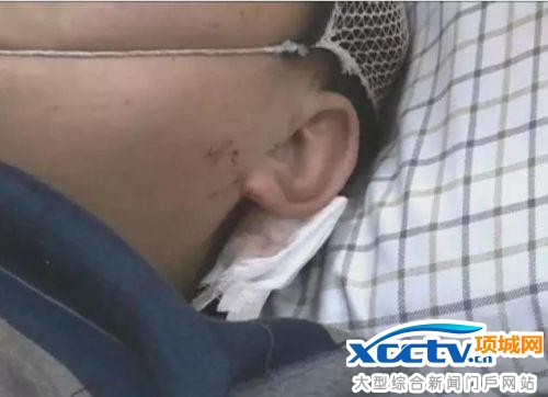 不容易!两快递员因送的慢被砖头砸头数十下