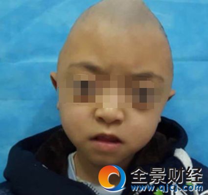 男童酷似外星人