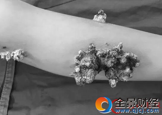 5岁男孩身上长发臭的