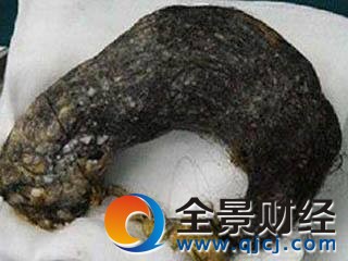 6岁女童患异食癖 补锌治疗食物有哪些 6岁女童患异食癖