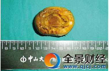 �����㹽�е�С�� ʳ�������Ǵ�����ʳ��С��