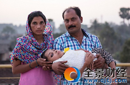 印度女孩骨头碎1000次 全身90%的骨头已经破裂