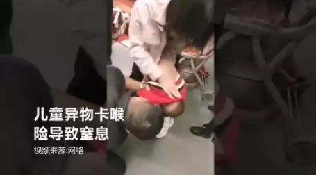 幼童异物卡喉 还好她及时出手相救