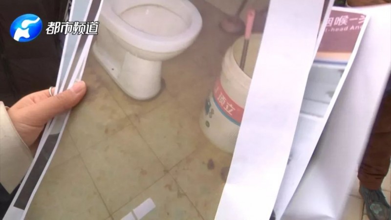 郑州一男子因家中管道堵塞找物业询问却被咬烂鼻子？物业：摔跤时牙齿挂的