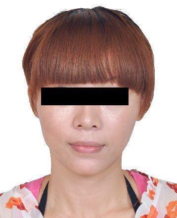 女子侵吞公司百萬資金后“人間蒸發(fā)” 整形成“別人”后仍被抓