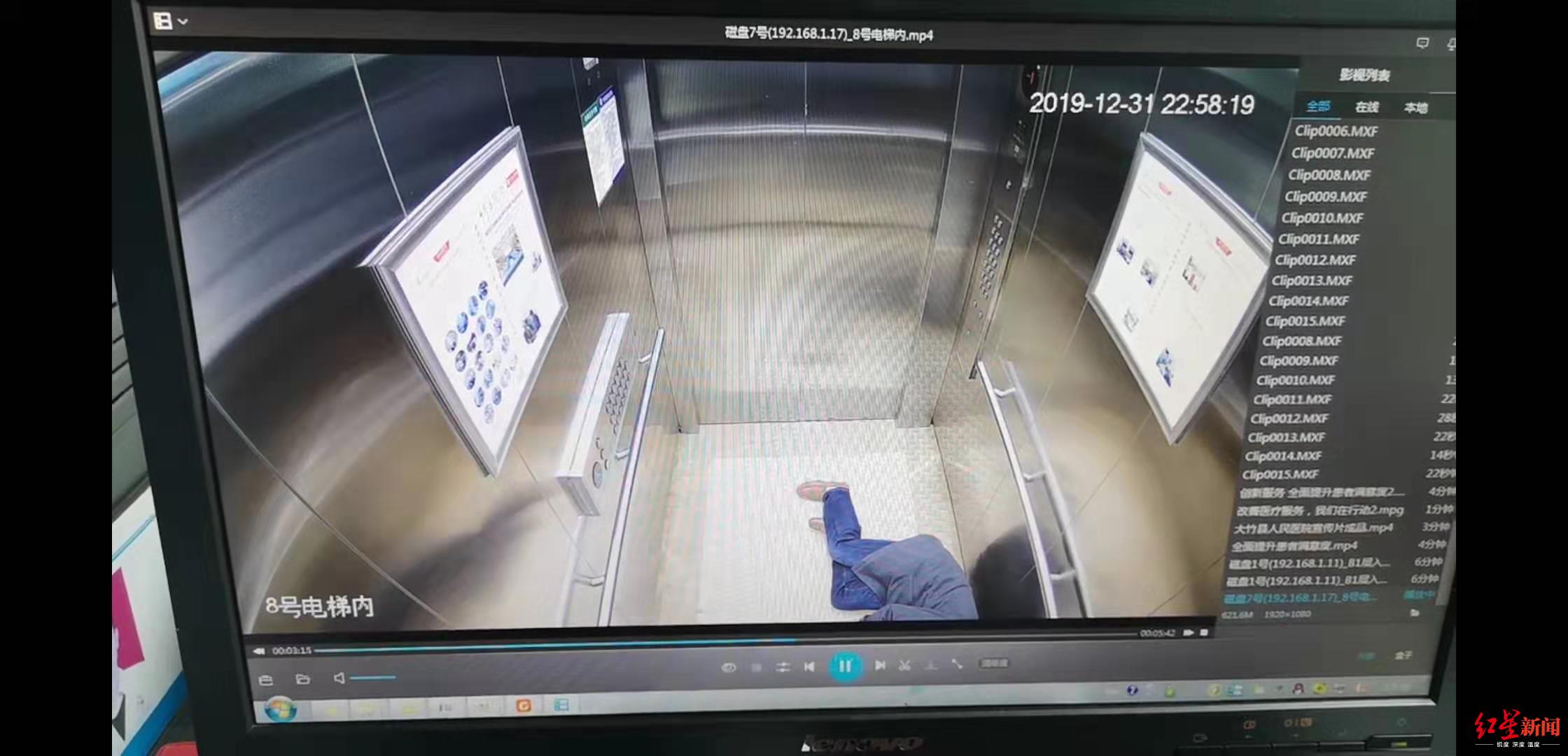 大竹縣一醫(yī)生被多臺手術(shù)累垮 站著睡著摔倒磕斷兩顆門牙