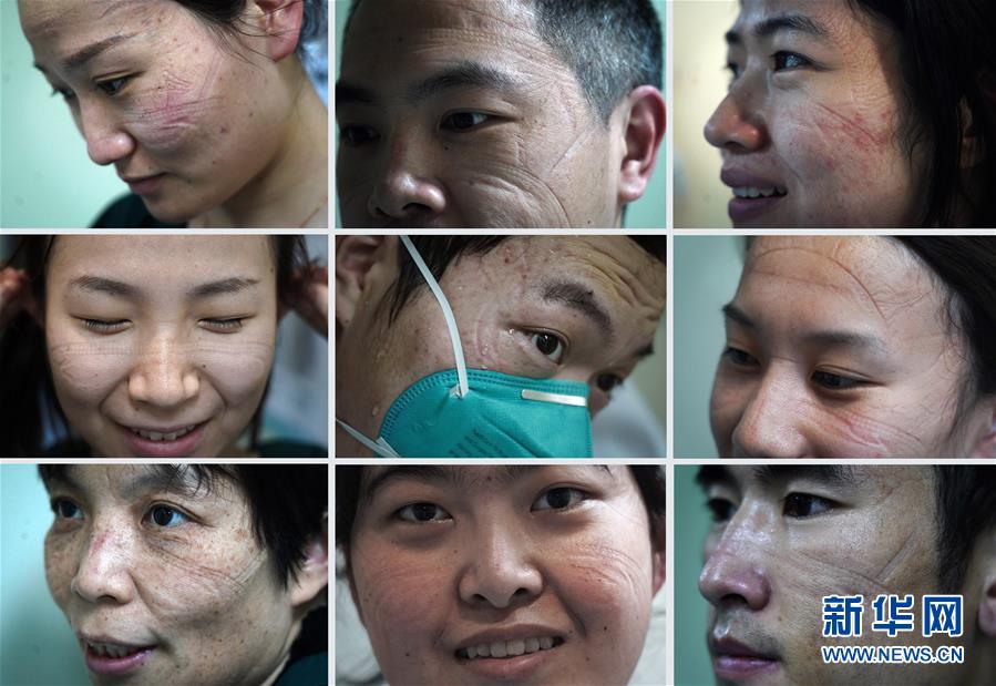 這些“最美印痕”  是他們用生命在為我們的生命保駕護(hù)航