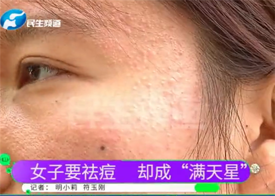 女子郑州市新雨池问题皮肤修复中心做祛痘 却成“满天星“