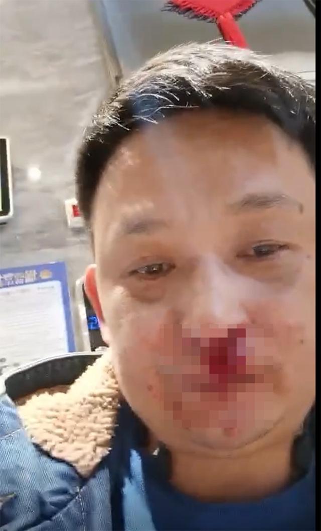 电梯让行无故被“群殴”致骨折 男子：不接受道歉希望依法处理