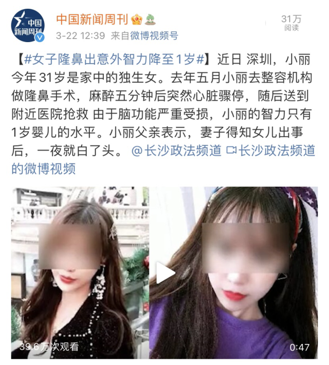 女子整容失败智力降到一岁 自信的女人最美丽？