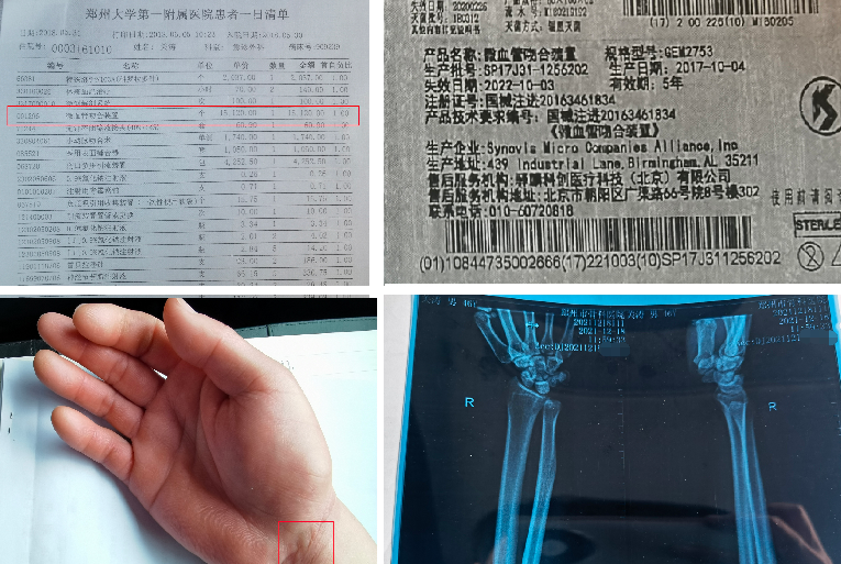 太过分！郑大一附院9患者付高价器材费却未被使用 